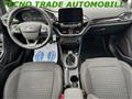 FORD FIESTA 1.1 75 CV Titanium NEOPATENTATI