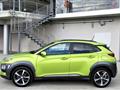 HYUNDAI KONA 1.0 T-GDI Xpossible