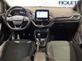 FORD FIESTA 1.0 Ecoboost Hybrid 125 CV 5 porte ST-Line