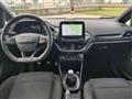 FORD FIESTA 1.0 Ecoboost 100 CV 5 porte ST-Line