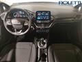 FORD FIESTA 1.1 75 CV 5 porte Titanium