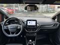 FORD FIESTA 1.5 TDCi 5 porte ST-Line