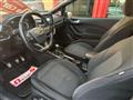 FORD Fiesta 3p 1.5 tdci ST-Line 120cv