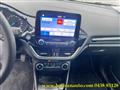 FORD FIESTA 1.1 75 CV 5 porte Titanium